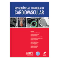 RESSONÂNCIA E TOMOGRAFIA CARDIOVASCULAR