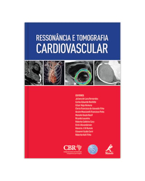 RESSONÂNCIA E TOMOGRAFIA CARDIOVASCULAR