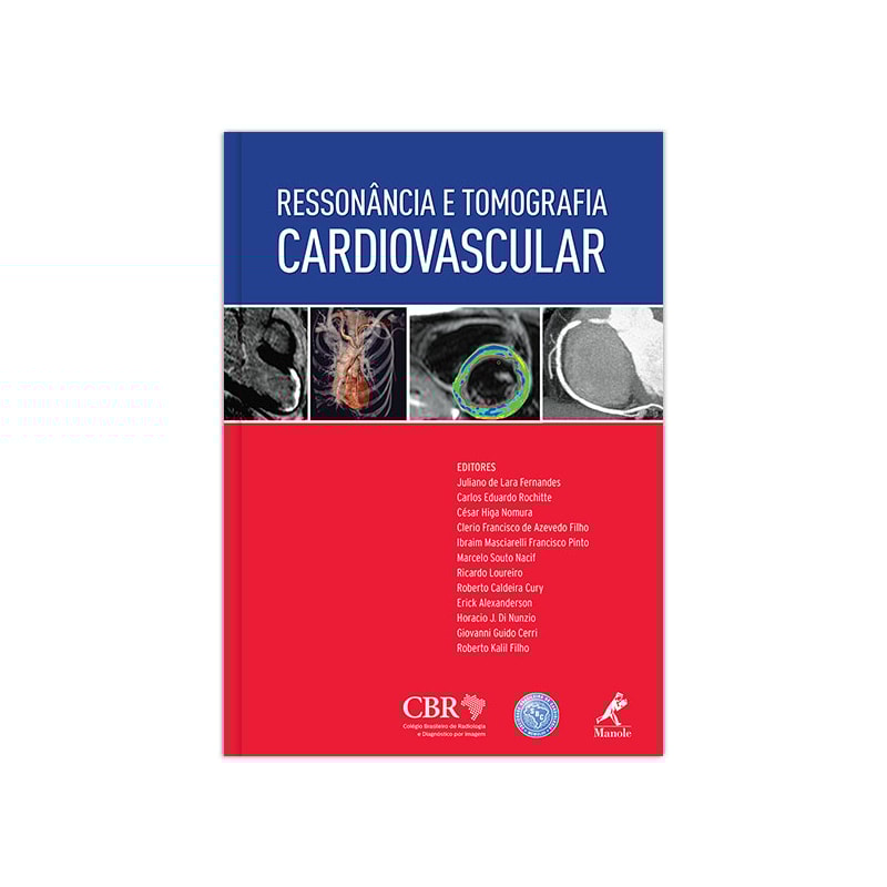 RESSONÂNCIA E TOMOGRAFIA CARDIOVASCULAR