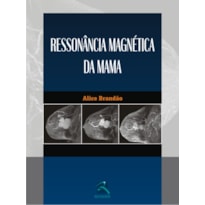RESSONÂNCIA MAGNÉTICA DA MAMA