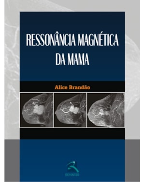 Ressonância magnética da mama