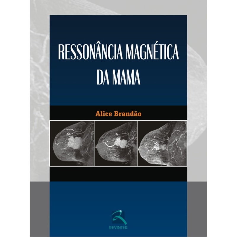 RESSONÂNCIA MAGNÉTICA DA MAMA