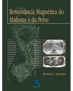RESSONÂNCIA MAGNÉTICA DO ABDOME E DA PELVE