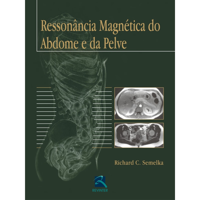 RESSONÂNCIA MAGNÉTICA DO ABDOME E DA PELVE
