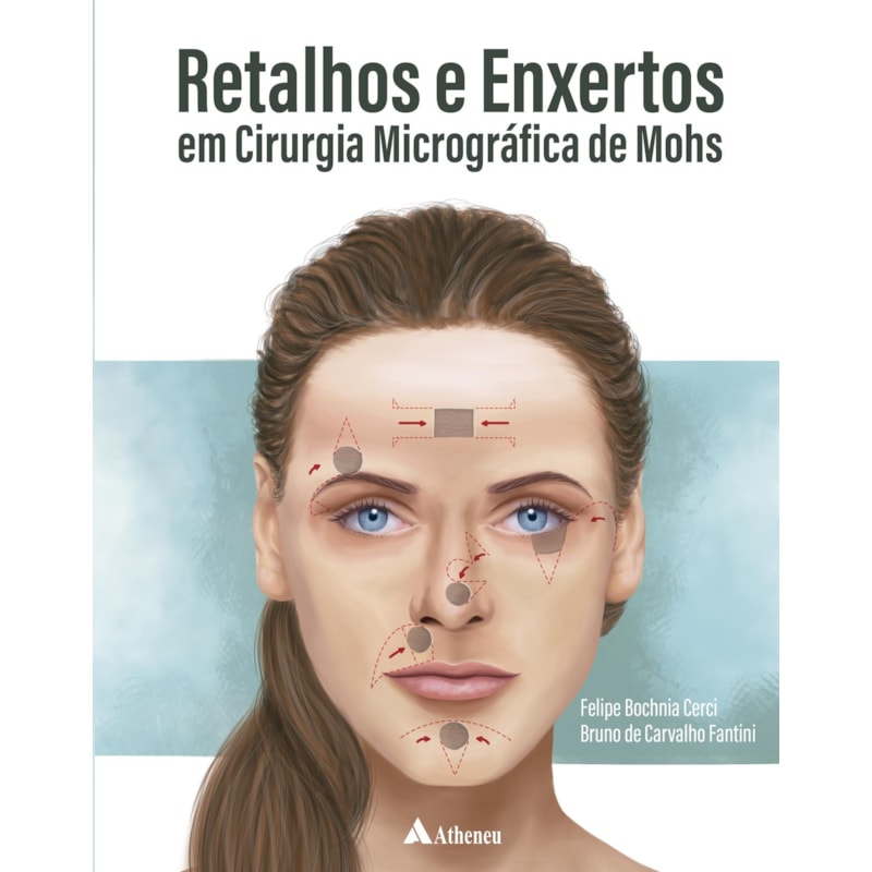Retalhos e enxertos em cirurgia micrográfica de Mohs