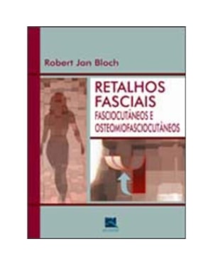 RETALHOS FASCIAIS, FASCIOCUTÂNEOS E OSTEOMIOFASCIOCUTÂNEOS