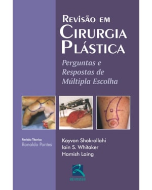 Revisão em cirurgia plástica: perguntas e respostas de múltipla escolha