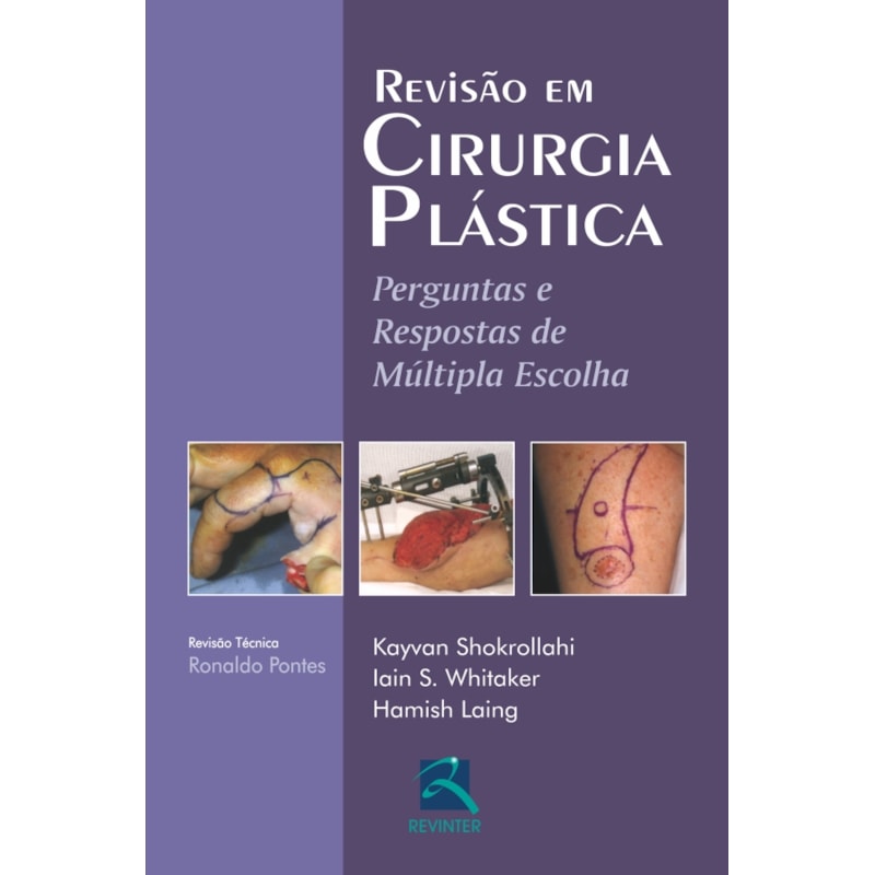 Revisão em cirurgia plástica: perguntas e respostas de múltipla escolha