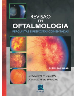 Revisão em oftalmologia: perguntas e respostas comentadas