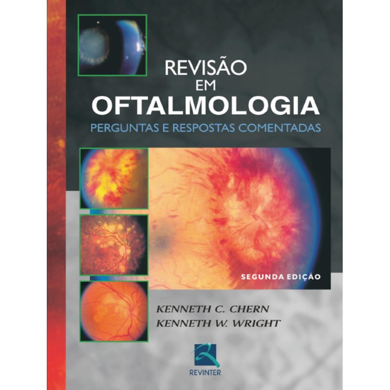Revisão em oftalmologia: perguntas e respostas comentadas