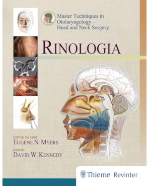 Rinologia