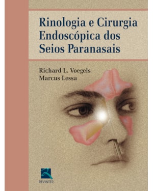 Rinologia e cirurgia endoscópica dos seios paranasais