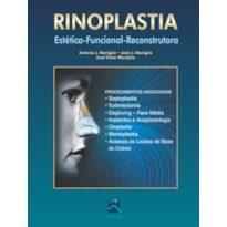 Rinoplastia: estética-funcional-reconstrutora