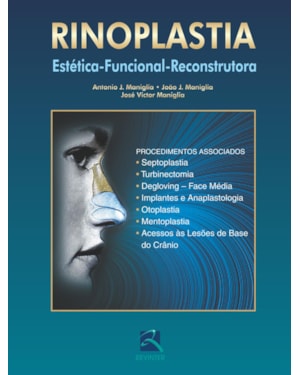 Rinoplastia: estética-funcional-reconstrutora