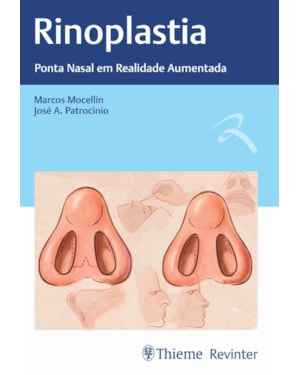 Rinoplastia: ponta nasal em realidade aumentada
