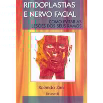 RITIDOPLASTIAS E NERVO FACIAL