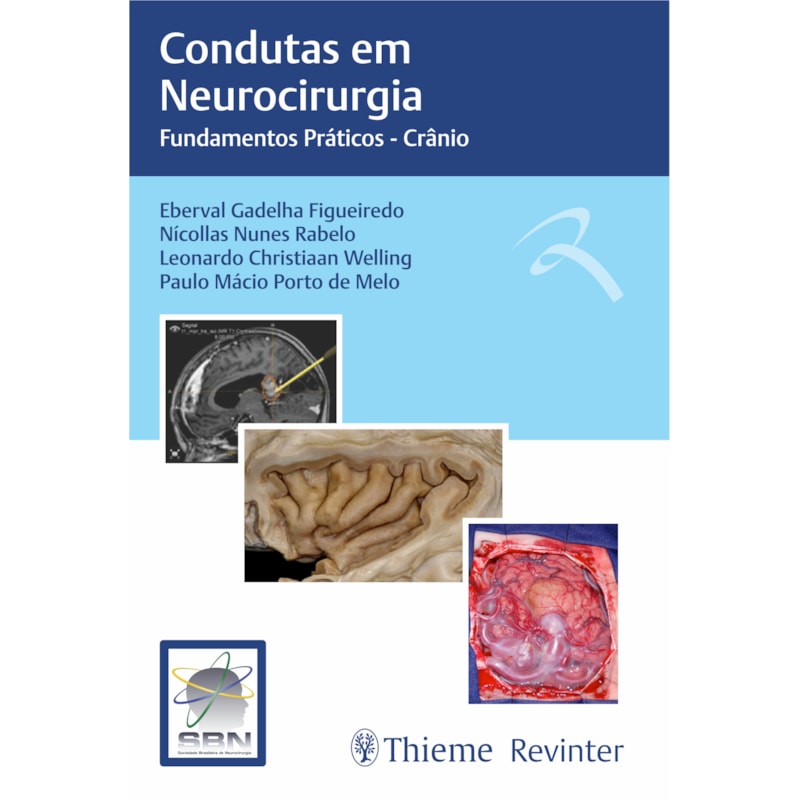 SBN CONDUTAS EM NEUROCIRURGIA: FUNDAMENTOS PRÁTICOS - CRÂNIO