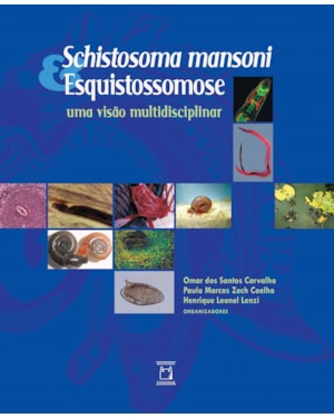 SCHISTOSOMA MANSONI & ESQUISTOSSOMOSE - UMA VISÃO MULTIDISCIPLINAR