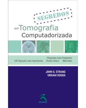 Segredos em tomografia computadorizada