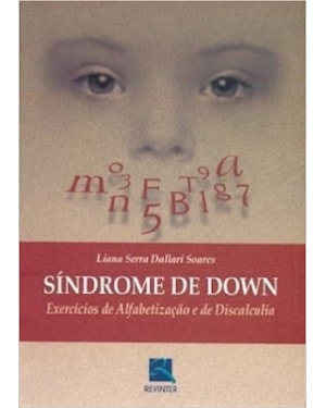 SINDROME DE DOWN - 1