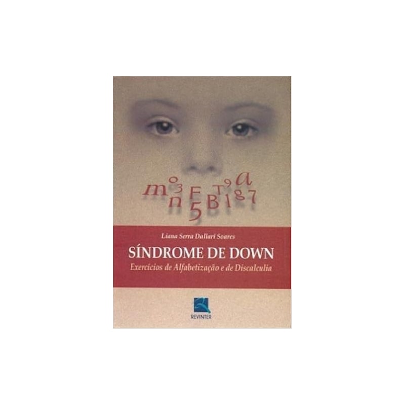 SINDROME DE DOWN - 1