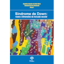 SÍNDROME DE DOWN