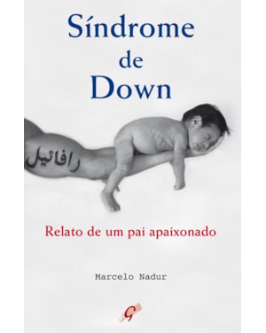 Síndrome de down: relato de um pai apaixonado