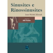SINUSITES E RINOSSINUSITES SINUSITES E RINOSSINUSITES
