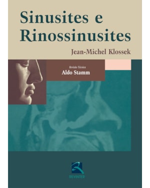 Sinusites e rinossinusites