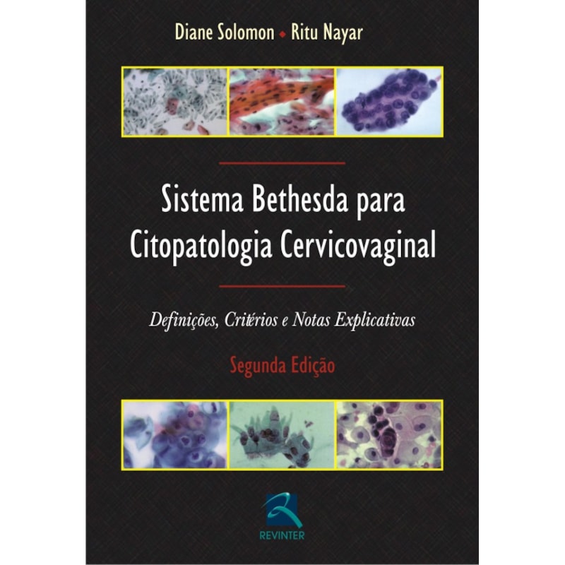SISTEMA BETHESDA PARA CITOPATOLOGIA CERVICOVAGINAL