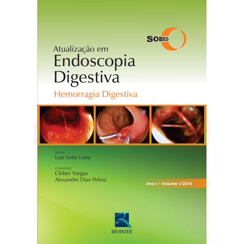 SOBED ATUALIZAÇÃO EM ENDOSCOPIA DIGESTIVA - VOLUME 1: HEMORRAGIA DIGESTIVA