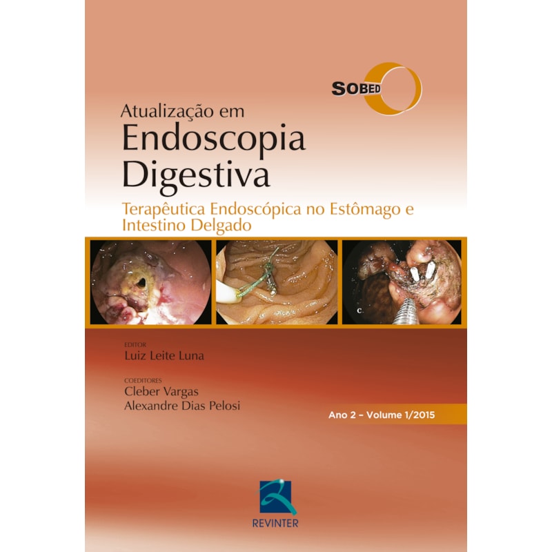 SOBED ATUALIZAÇÃO EM ENDOSCOPIA DIGESTIVA - VOLUME 1: TERAPÊUTICA ENDOSCÓPICA NO ESTÔMAGO E INTESTINO DELGADO - ANO 2