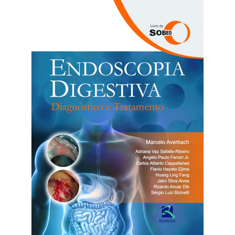 SOBED ENDOSCOPIA DIGESTIVA: DIAGNÓSTICO E TRATAMENTO