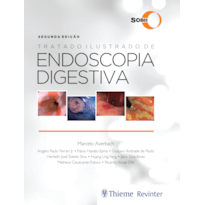 SOBED TRATADO ILUSTRADO DE ENDOSCOPIA DIGESTIVA