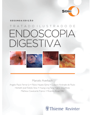 Sobed tratado ilustrado de endoscopia digestiva