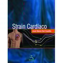 STRAIN CARDÍACO