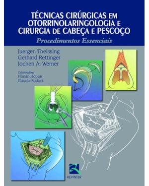Técnicas cirúrgicas em otorrinolaringologia e cirurgia de cabeça e pescoço: procedimentos essenciais