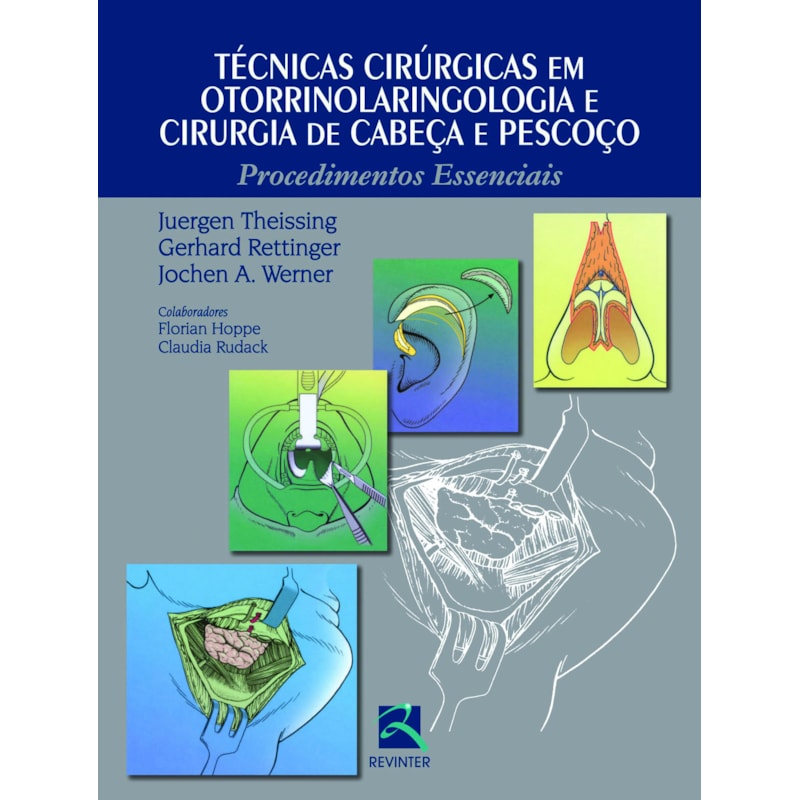 Técnicas cirúrgicas em otorrinolaringologia e cirurgia de cabeça e pescoço: procedimentos essenciais
