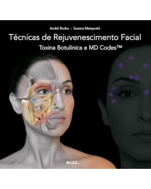 TÉCNICAS DE REJUVENESCIMENTO FACIAL: TOXINA BOTULÍNICA E MD CODES