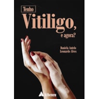 TENHO VITILIGO, E AGORA?