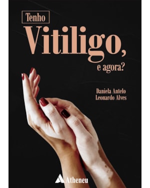 Tenho vitiligo, e agora?