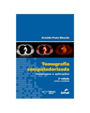 TOMOGRAFIA COMPUTADORIZADA: TECNOLOGIAS E APLICAÇÕES