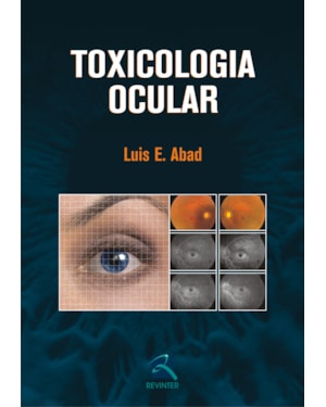 Toxicologia ocular