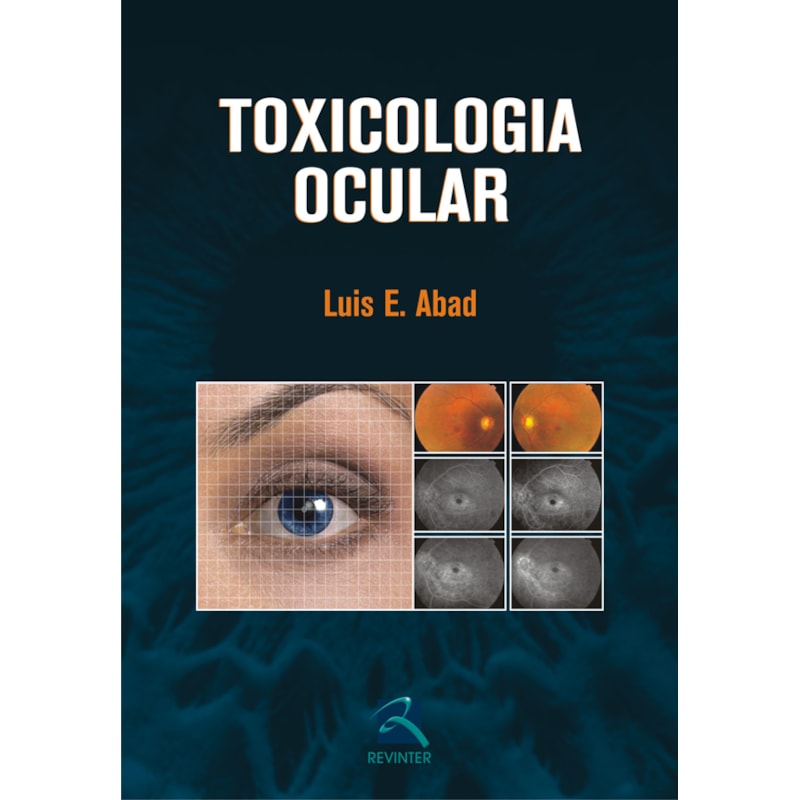 Toxicologia ocular