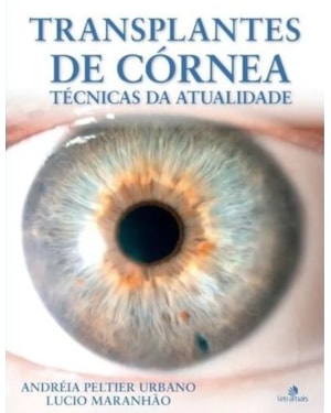 TRANSPLANTES DE CÓRNEA