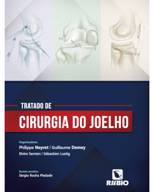 Tratado de cirurgia do joelho