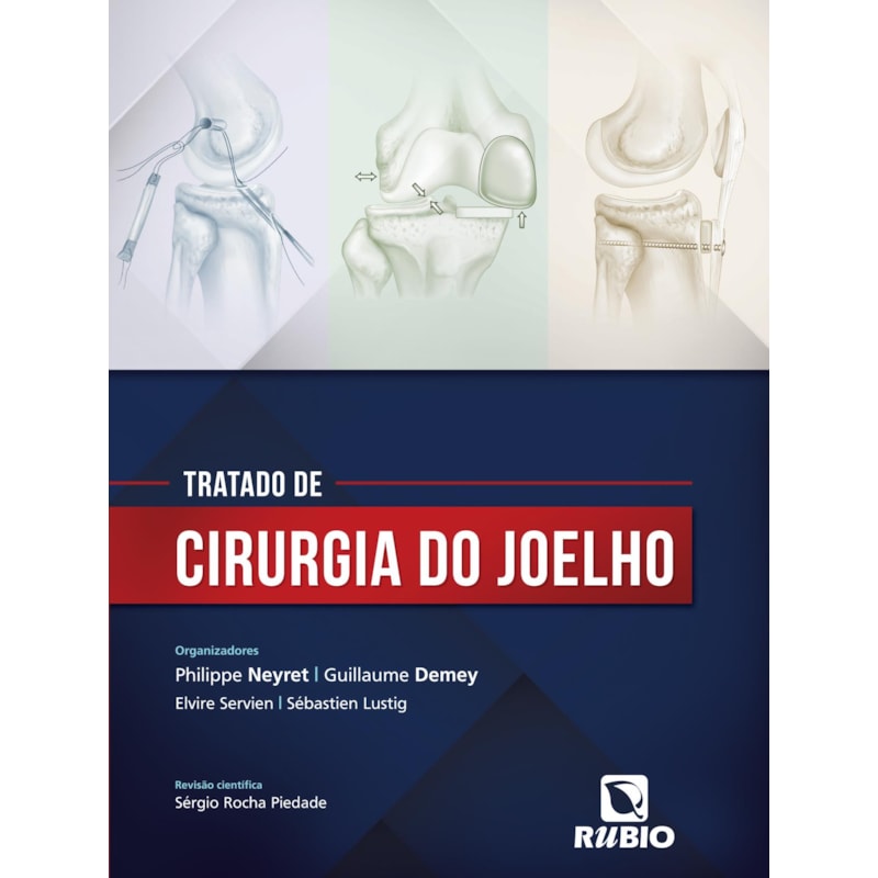 TRATADO DE CIRURGIA DO JOELHO