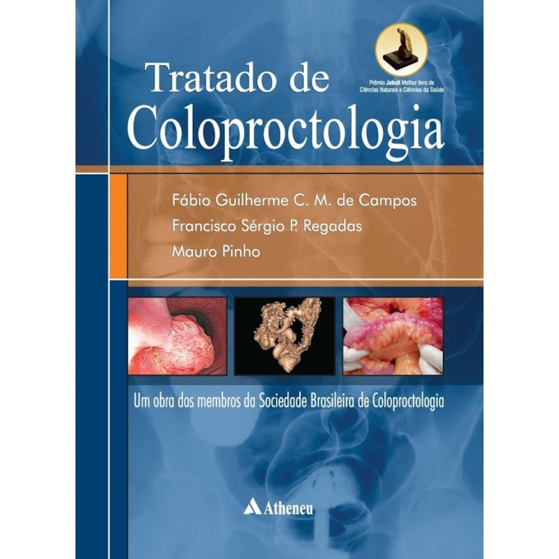 Tratado de coloproctologia: Uma obra dos membros da Sociedade Brasileira de Coloproctologia