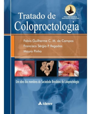 Tratado de coloproctologia: Uma obra dos membros da Sociedade Brasileira de Coloproctologia