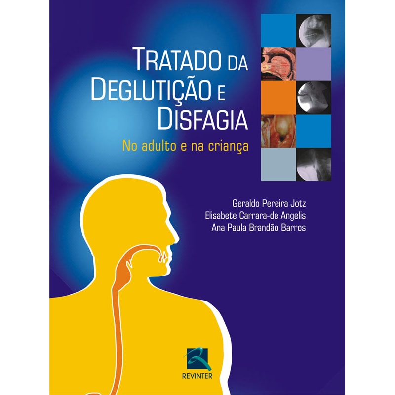 Tratado de deglutição e disfagia: no adulto e na criança